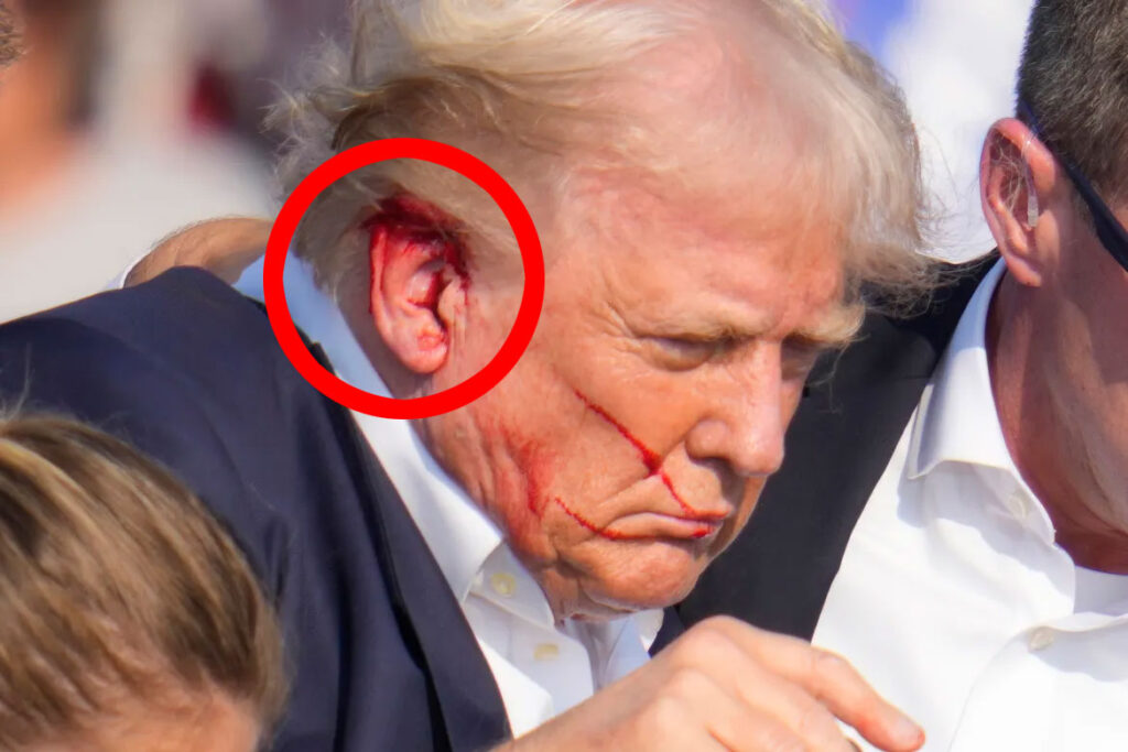 trump-bullet-ear-prophecy-1024x683